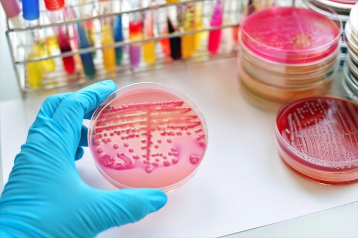 Bacteria in petri dish
