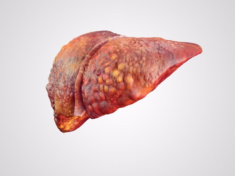 Liver Disease / Hepatic Disease