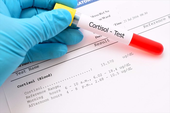 Close-up of blood sample for cortisol hormone testing.