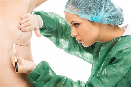 Breast Lift (Mastopexy)