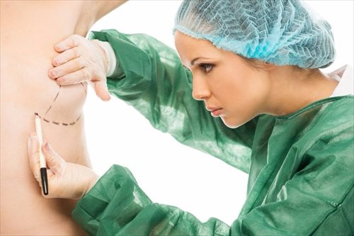 Breast Lift (Mastopexy)