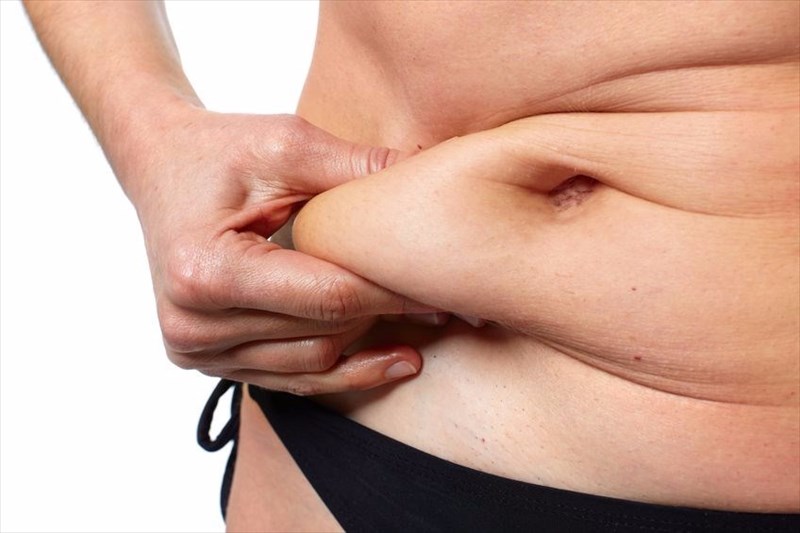 Who benefits from an abdominoplasty (tummy tuck)?