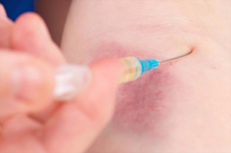 Side effects and complications of Botox