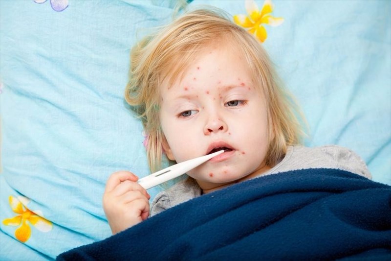 What are the complications and risks of measles?