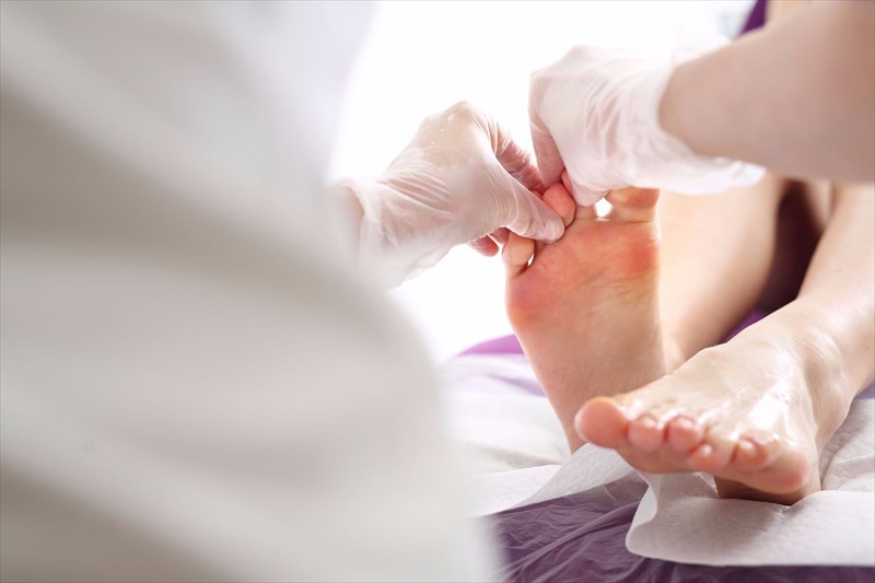 Diagnosing athlete's foot