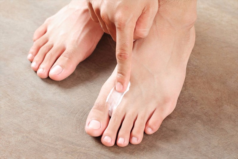 Treating athlete's foot