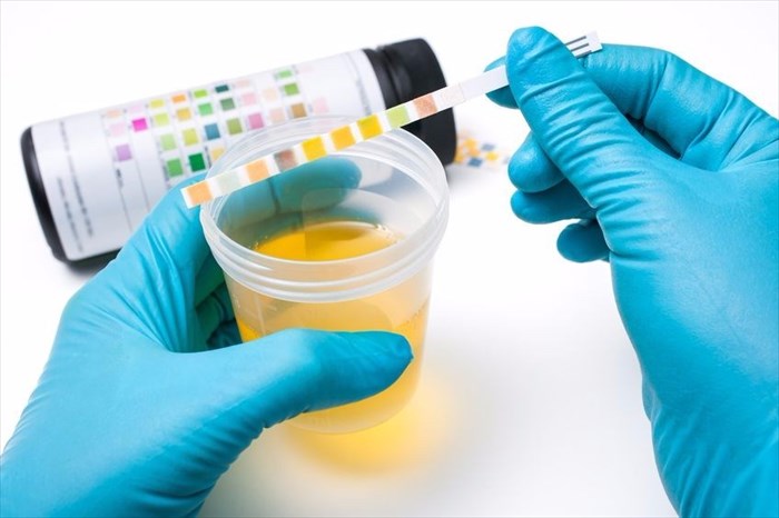 Urine test in laboratory.
