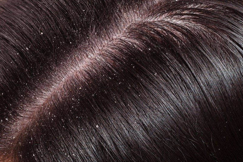 Can your hair and scalp also show signs of ill-health?