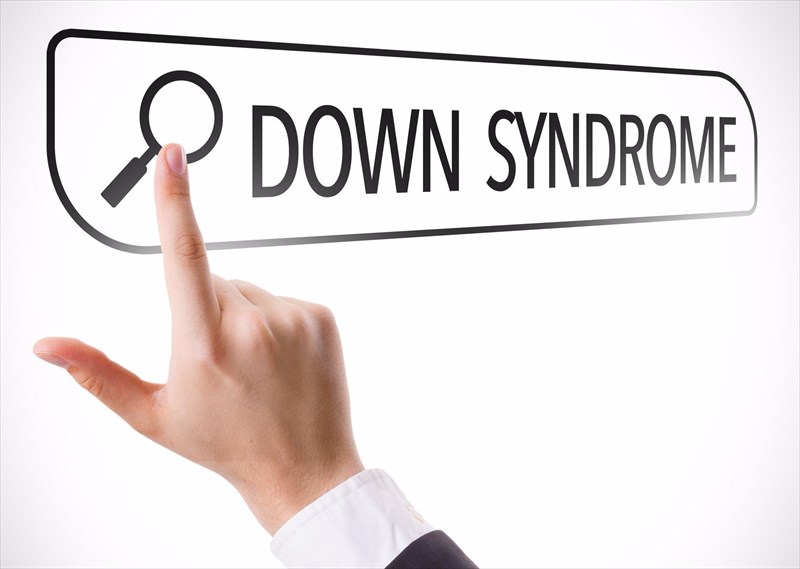 is-it-known-why-down-syndrome-happens
