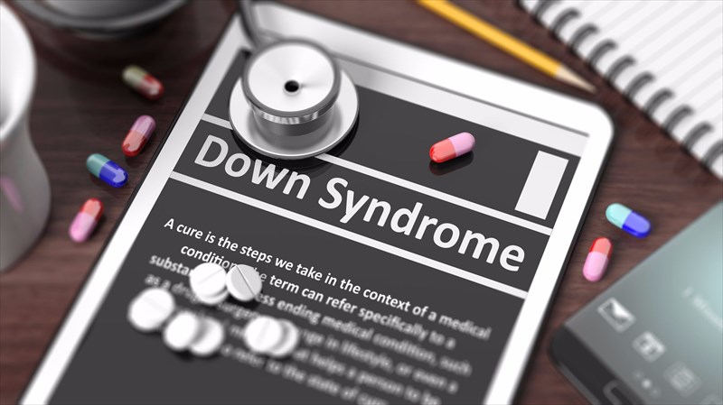 down syndrome treatment