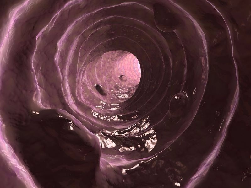 What do my colonoscopy results mean?