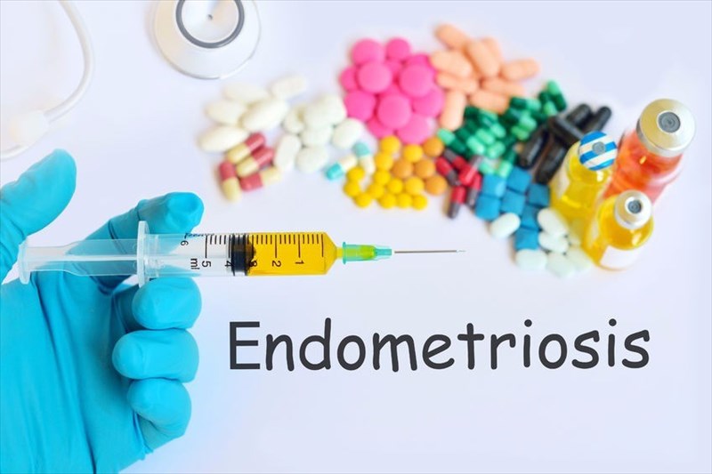 How is endometriosis treated?