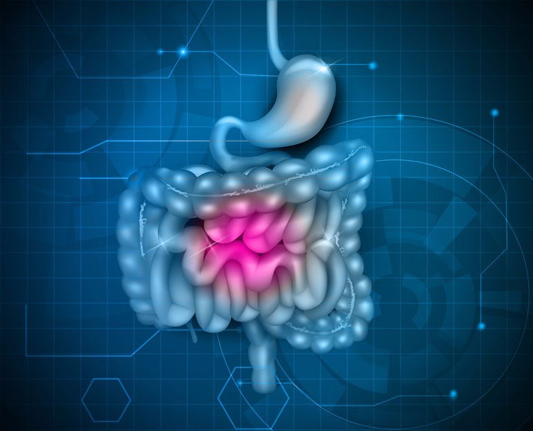 How does Crohn's disease affect the intestines?