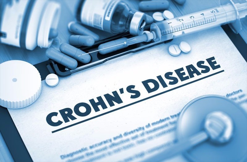 What are the types of Crohn’s disease?