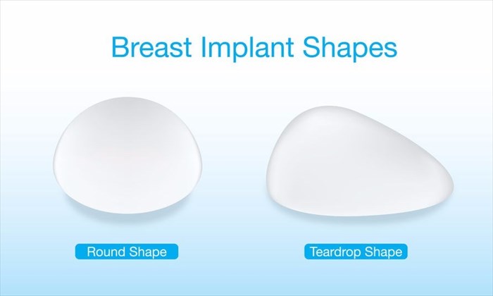 Breast implant types, shapes and textures