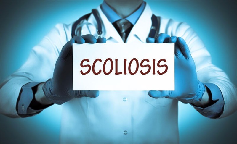Scoliosis