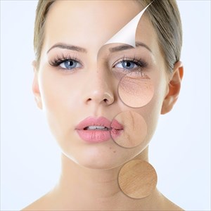 Fine line and wrinkle comparison on woman's face.