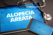 Alopecia Areata (non-scarring hair loss)