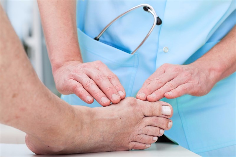 How are bunions diagnosed?