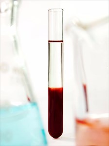 Blood and plasma in a test tube.