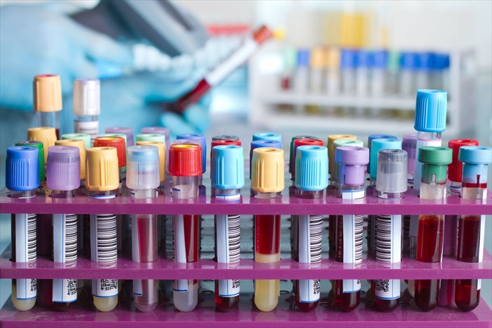 Rack of blood sample tubes with barcode labels.