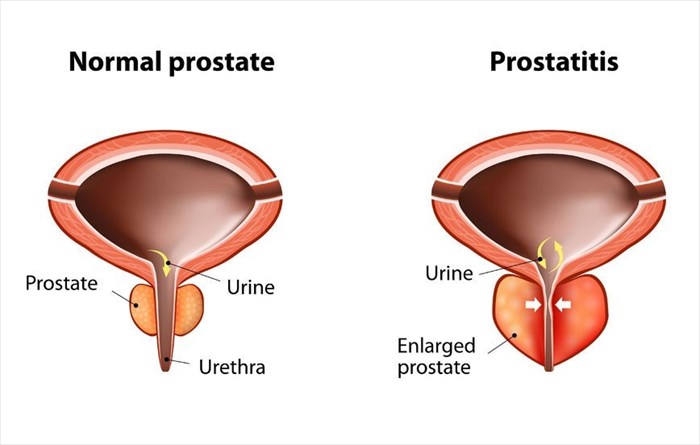 What are the causes of frequent urination?