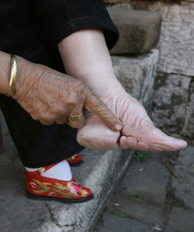 Bound Asian Feet - What did the process of foot binding entail?