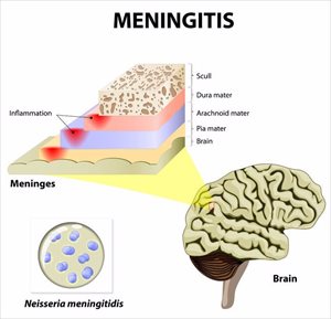 Human brain and meningococcal bacteria. 
