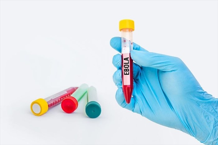 Close-up of a hand holding a test-tube with a blood sample for EBOLA testing.