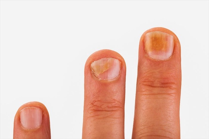 What Your Nails Can Tell You About Your Health