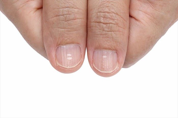 What your nails can tell you about your health