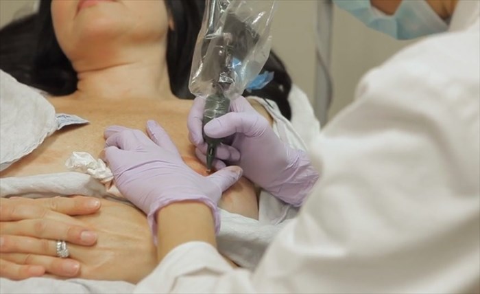 Medical tattoo - nipples after mastectomy