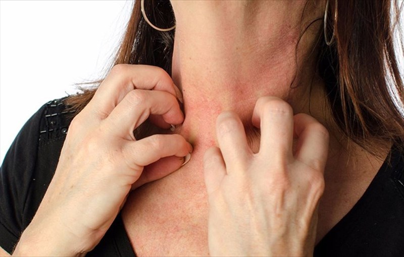 What causes or triggers hives?