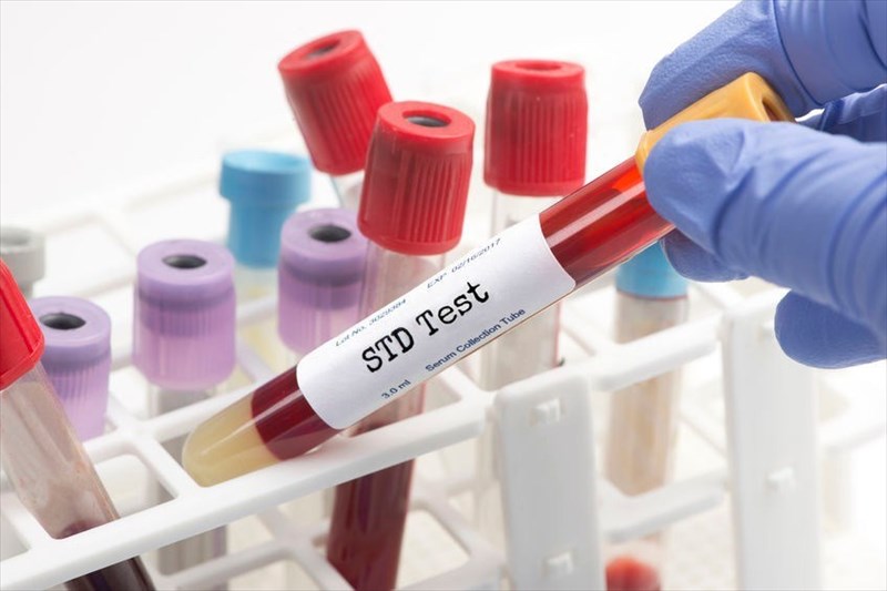 Can An Std Test Be False Negative