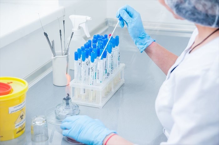 Medical tests for vaginal discharge