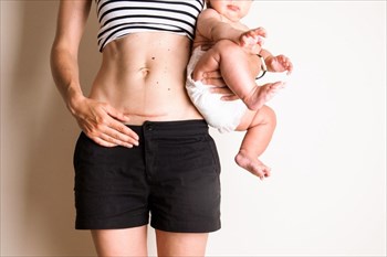 A step-by-step guide to C-Sections