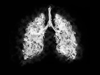 Is a mysterious lung illness caused by vaping? The CDC is investigating…