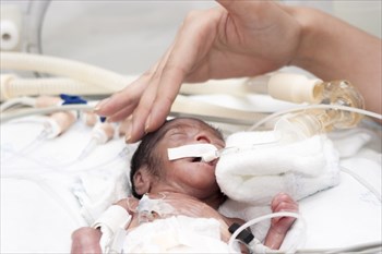 Home Environments influence premature babies’ prospects