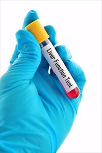 Blood sample for liver function test