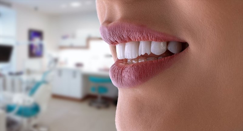 Broken or Chipped Tooth? What You Need to Know