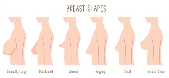 lovitură Discrepanţă Politicos do i need a breast lift Bere regele