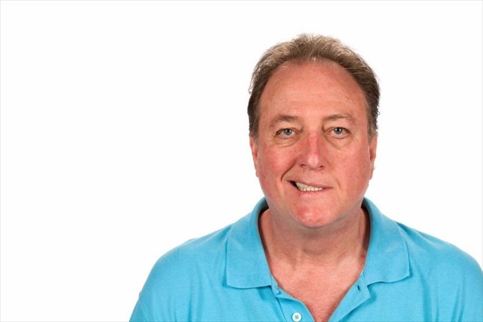 Mature man with Bell's palsy paralysis of the facial nerves.