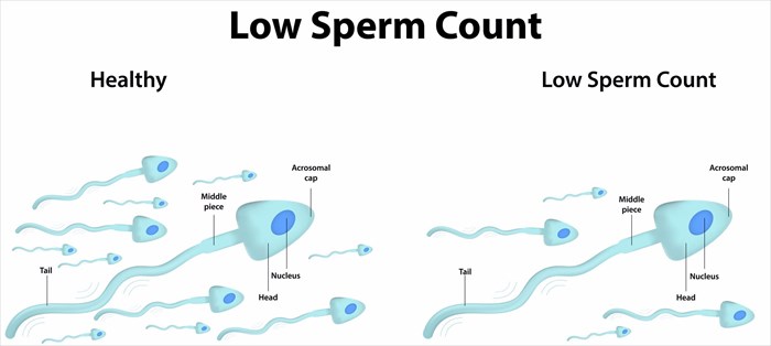 Illustration showing the difference between healthy and low count sperm.