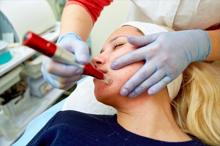 Dermabrasion