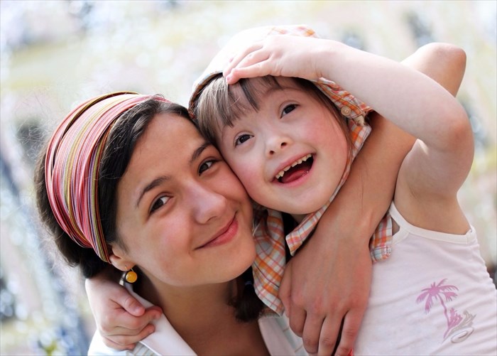 Young mother and her daughter (with down syndrome).